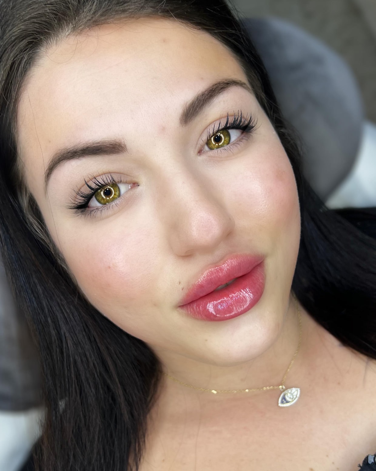 A client after lip enhancement